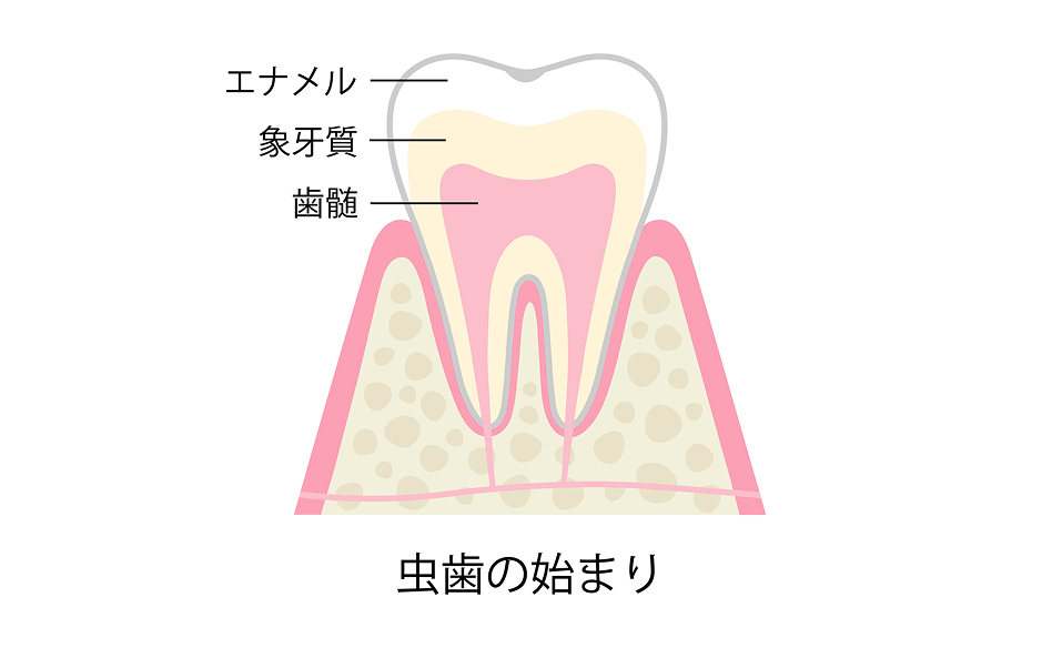 経過観察をお勧めする場合の状態